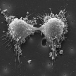 Cancer Cell Division Photograph By Steve Gschmeissner science Photo Library