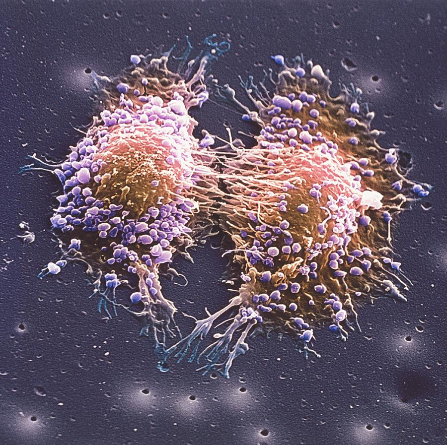 Cancer Cell Division Photograph By Steve Gschmeissner